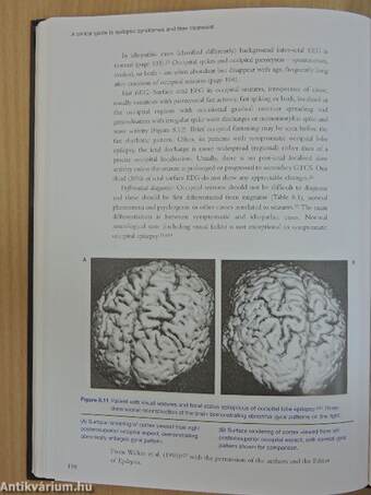 A Clinical Guide to Epileptic Syndromes and their Treatment