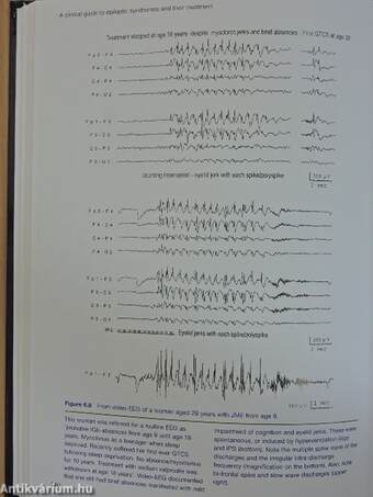 A Clinical Guide to Epileptic Syndromes and their Treatment