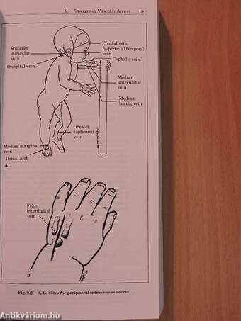 Handbook of Pediatric Emergencies