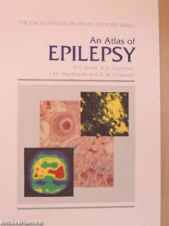 An Atlas of Epilepsy