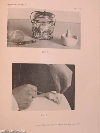 Acute Lobar Pneumonia