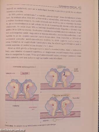 Atherosclerosis