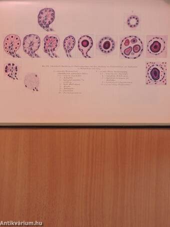 Die Pathologie des Kindlichen Pankreas