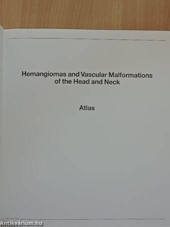 Hemangiomas and Vascular Malformations of the Head and Neck