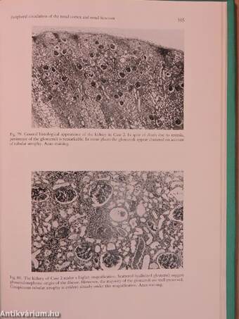 Morphological and Morphometrical Analysis of Circulation in Hypertension and Ischemic Kidney