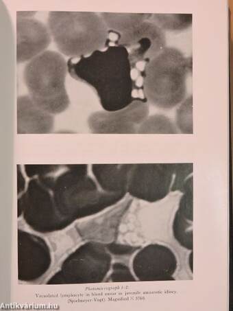 Acta Ophthalmologica 1964.