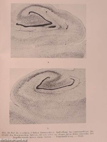 Histopathologie und klinische Symptomatologie der anoxisch-vasalen Hirnschädigungen