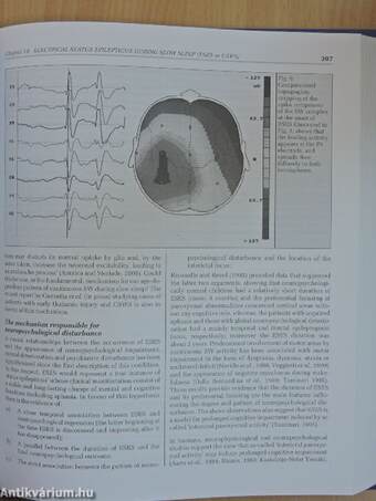 Epileptic Syndromes in Infancy, Childhood and Adolescence - CD-vel