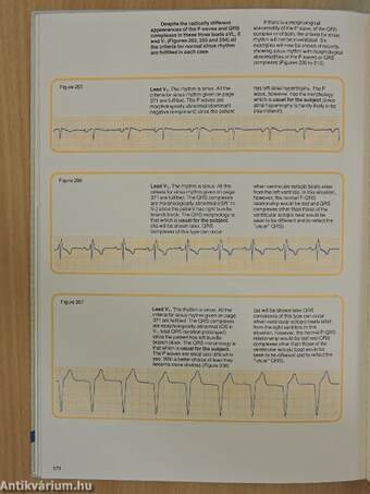 Understanding the Electrocardiogram 3