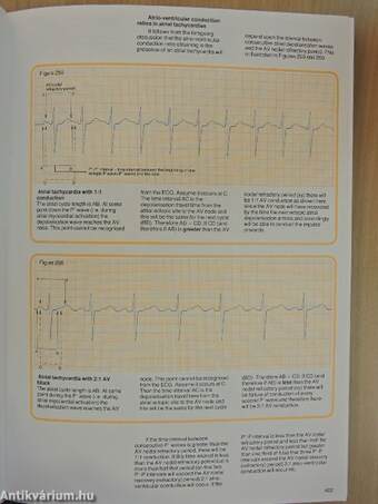 Understanding the Electrocardiogram 3