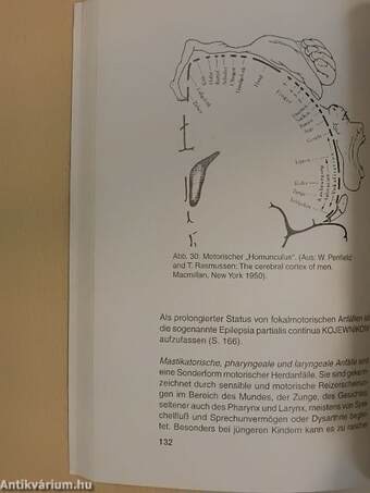 Epilepsien im Kindes- und Jugendalter