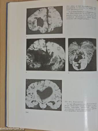 A klinikai neurológia alapjai