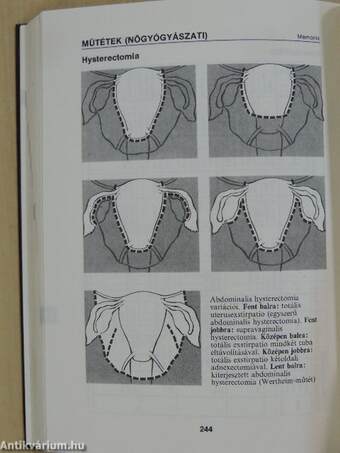 Nőgyógyászat