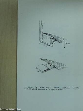 Újabb eredmények a szemészetben 1991/2.