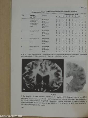 Válogatott fejezetek a neuropsychiatriából