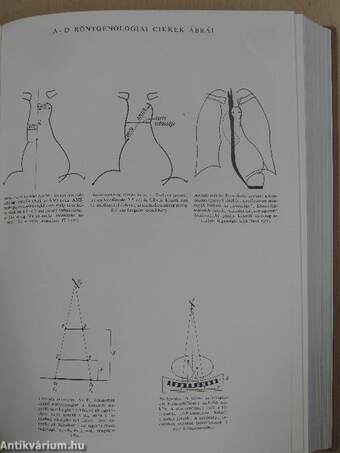 Orvosi lexikon 1. (töredék)