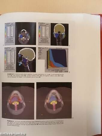 Principles and Practice of Radiation Oncology