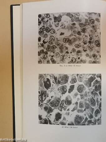 Chemotherapy of neoplastic diseases