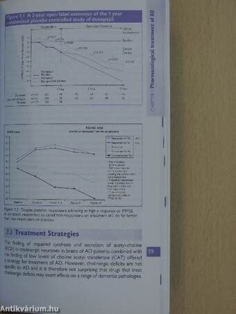 Alzheimer's Disease