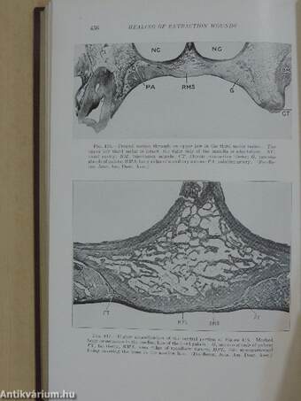 Histopathology of the Teeth and their Surrounding Structures