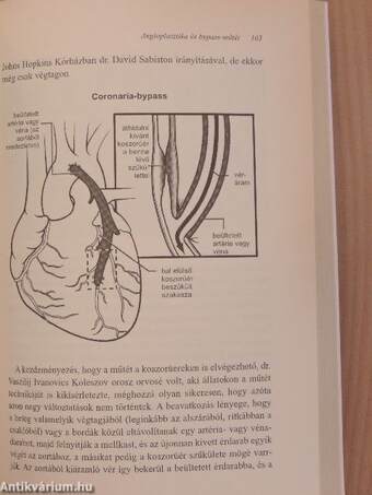 Szívbetegségek