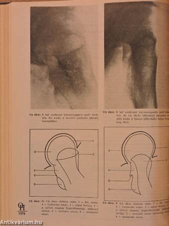 Orvosi Hetilap 1985. január-december I-II.