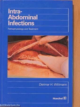 Intra-Abdominal Infections