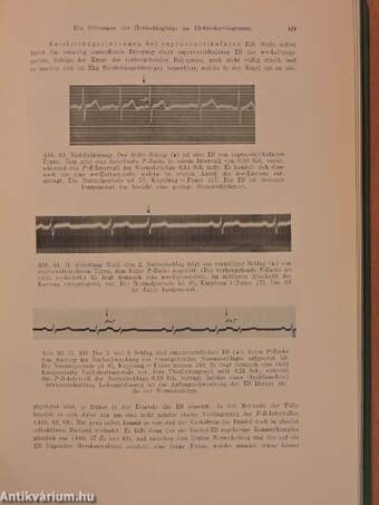 Klinische Elektrokardiographie