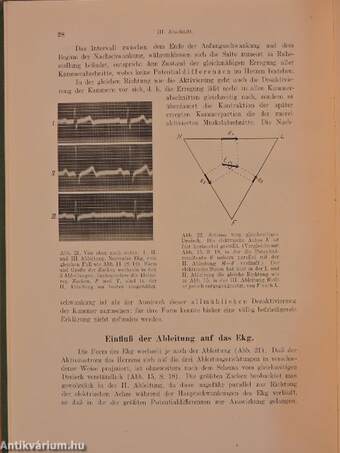 Klinische Elektrokardiographie