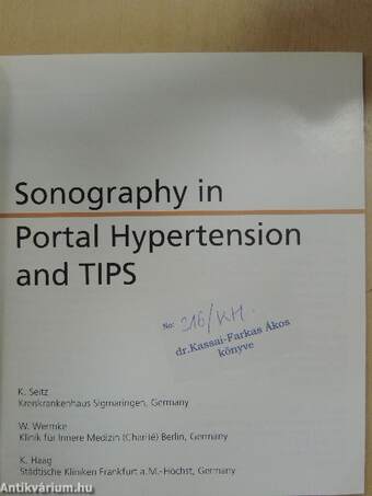 Sonography in Portal Hypertension and TIPS