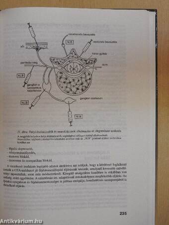 A fájdalom és csillapítása