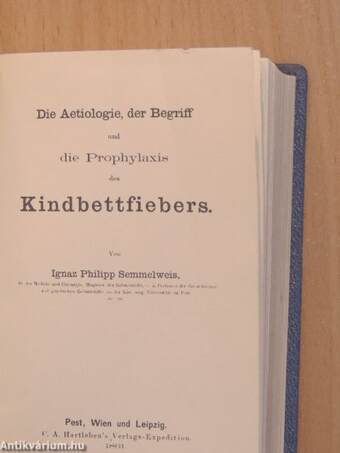 Die Aetiologie, der Begriff und die Prophylaxis des Kindbettfiebers