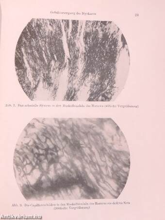 Anatomie und Pathologie der Gefässversorgung des Herzens