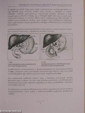 Posztoperatív enzimhiányos állapotok és belgyógyászati kezelésük