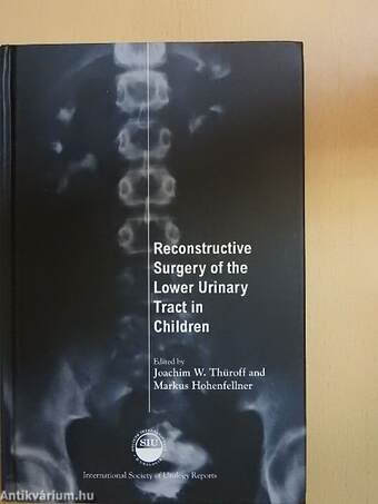 Reconstructive Surgery of the Lower Urinary Tract in Children