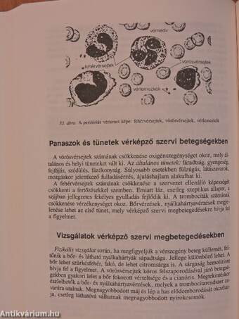 Klinikai ismeretek a belgyógyászat köréből ápolónők részére