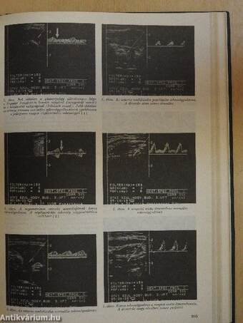 Magyar Nőorvosok Lapja 1985-1986. január-december