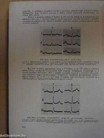 Klinikai és kísérleti elektrokardiographia