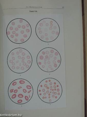 Atlas des normalen und pathologischen Knochenmarkes