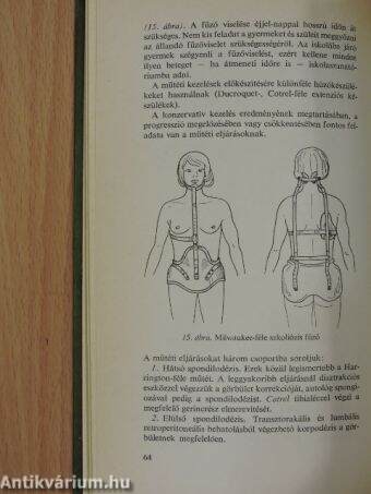 A gerincbetegségek differenciáldiagnosztikája az ortopédiában