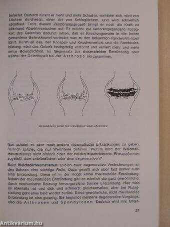 Ratgeber für Rheumakranke