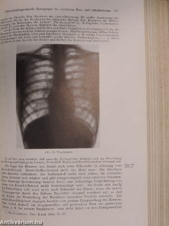 Lehrbuch der Differentialdiagnose innerer Krankheiten