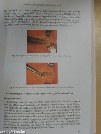 Thermal Analysis in Medical Application