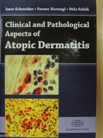 Clinical and Pathological Aspects of Atopic Dermatitis