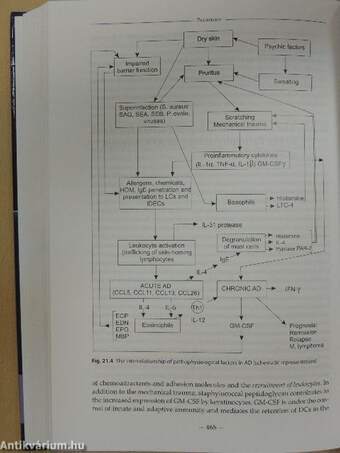 Clinical and Pathological Aspects of Atopic Dermatitis