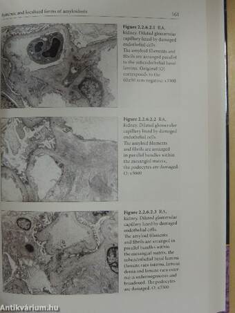 Clinical Pathology of Rheumatoid Arthritis