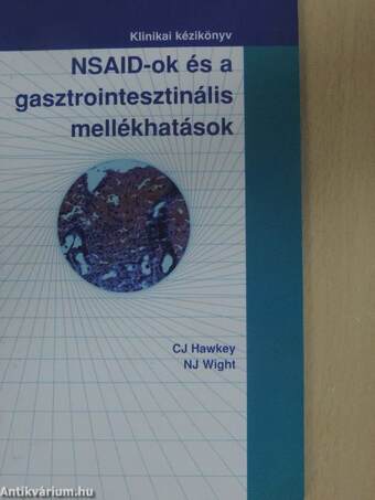 NSAID-ok és a gasztrointesztinális mellékhatások