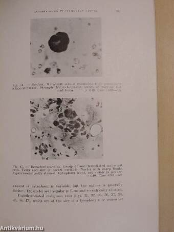 Cytodiagnosis in pulmonary cancer