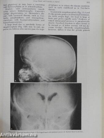 The Radiologic Clinics of North America August 1975