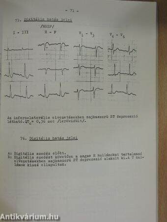 EKG-atlasz